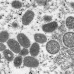 美國宣布猴痘為公衛緊急事件 破6600例全球最多