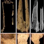 科學家發現3.1萬年前骨骼 為最早截肢手術證據
