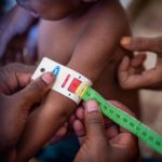聯合國：西非3國今年恐近百萬幼童嚴重營養不良