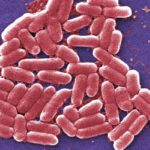 污水外洩導致太浩湖中大腸桿菌（E. coli）含量升高?!😱