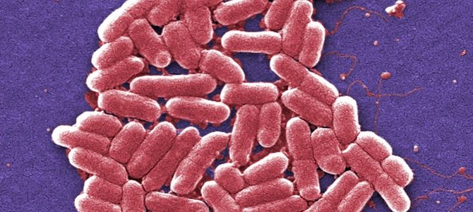 污水外洩導致太浩湖中大腸桿菌（E. coli）含量升高?!😱