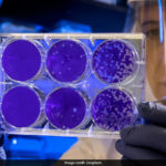 「夢魘細菌」 (Nightmare bacteria)案例在美國持續增加↗️