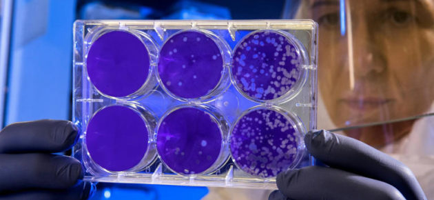 「夢魘細菌」 (Nightmare bacteria)案例在美國持續增加↗️