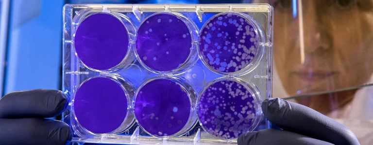 「夢魘細菌」 (Nightmare bacteria)案例在美國持續增加↗️